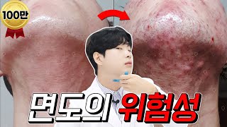 Eng) "여드름 피부 극복기!"✨ l [역대급 비법 공개⚡️] l ※안보면 X손해 주의※ l  "피부는민동성"