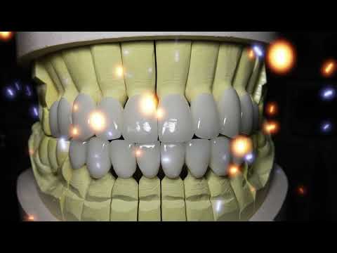 Zirconia Crown Upper & Lower