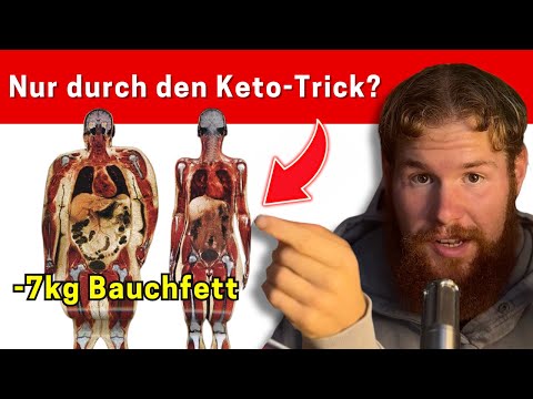 Ketosis + Intermittent Fasting = Extremely Fast Fat Loss (Step-by-Step Guide)