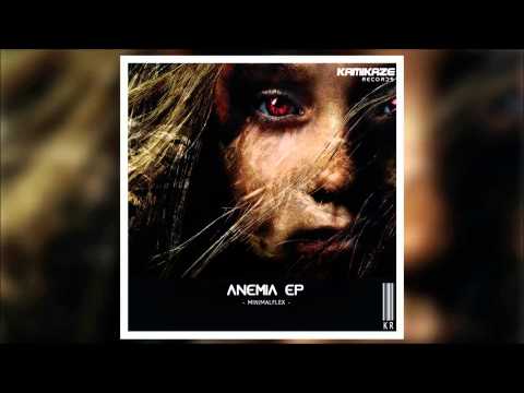 MinimalFlex - Anemia (Original Mix)