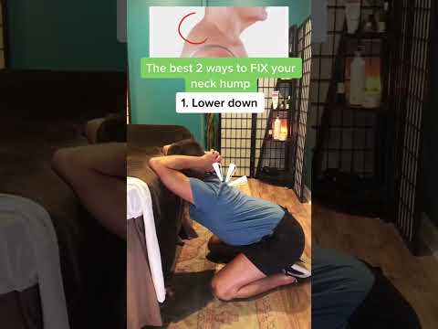 The best 2 ways to fix your neck hump! #health #backpain #backpainrelief #neckpain