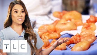 68 Lipomas Removed From a Patient&#39;s Arms! | Dr. Pimple Popper