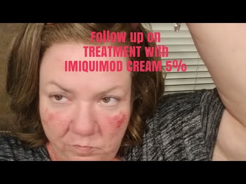 Follow up on Treatment with Imiquimod Cream 5 percent