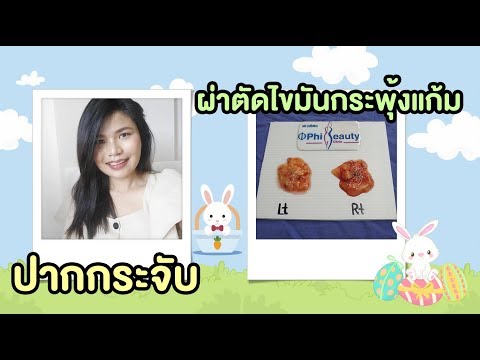 ทําปากกระจับ