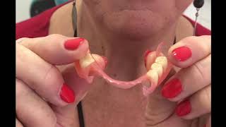 Valplast Denture