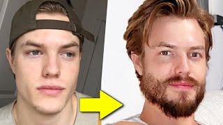 How to Grow a Beard From Nothing (FULL GUIDE)