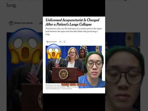 ACUPUNCTURE GONE WRONG ❌ Make sure to get it done only by licensed acupuncturist!