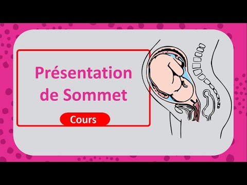 La présentation du sommet 👶Tout savoir sur l'accouchement 🤓 - Cours - Gynéco_obstétrique