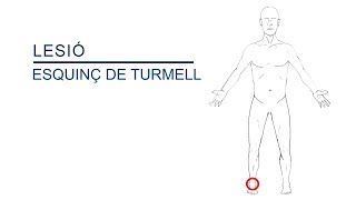 ESQUINÇ DE TURMELL GRAU 2 [DANIEL BERASTEGUI] #21: el que ET FALTA SABER👌!