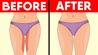 5 natural ways to get rid of thigh rashes