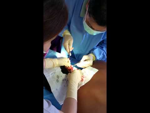 Kung uminom ka ng luya tea sa isang linggo sa kung magkano ang maaari kang mawalan ng timbang Kung Tomatoes ay kapaki-pakinabang para sa pagbaba ng timbang