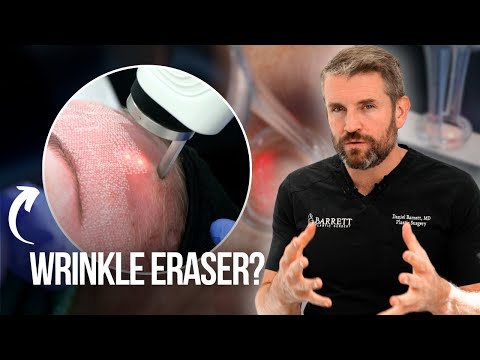 Why CO2 Laser Is the Ultimate Skin Fix!