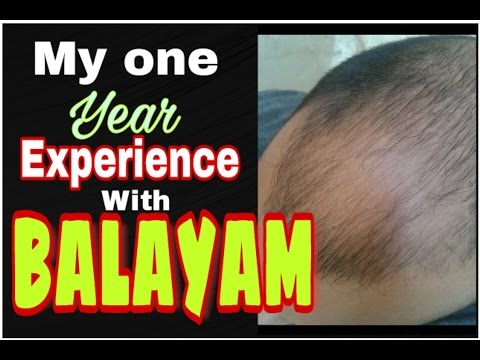 balayam-before-after Mp4 3GP Video & Mp3 Download unlimited Videos Download balayam-before-after Mp4 3GP Video & Mp3 Download unlimited Videos Download