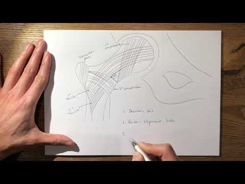11  Trabecular Pattern FRCS Tr&Orth