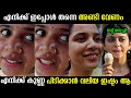 കുട്ടി നാട്ടിൽ നടക്കാനാ കാര്യം അറിയാ