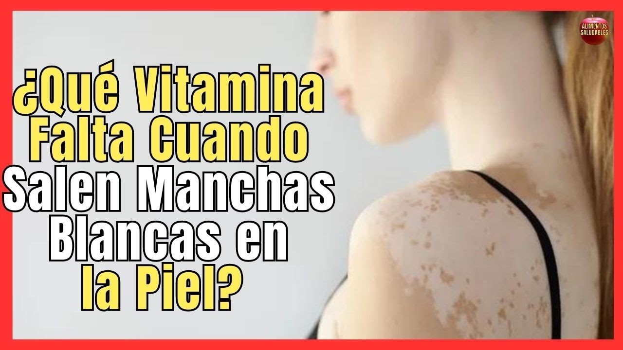 ¿La deficiencia de vitamina B12 provoca manchas blancas en la piel