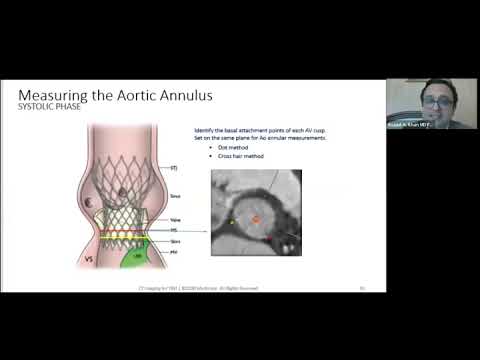 Imaging For TAVI – Fellow Training Session (PSIC)