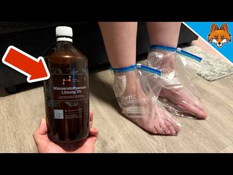 Kippe Wasserstoffperoxid auf deine Füße und STAUNE WAS PASSIERT💥(2x pro Woche)🤯
