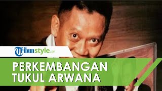 Pulang dari Rumah Sakit, Tukul Arwana Sudah Bisa Duduk dan Berdiri meski Berat Badan Turun Drastis