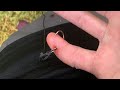 Removing A Fishing Hook From Finger (GRAPHIC)