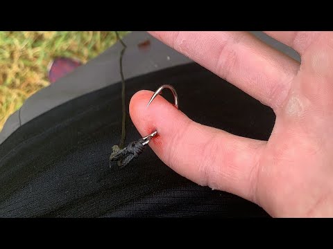 Removing A Fishing Hook From Finger (GRAPHIC)