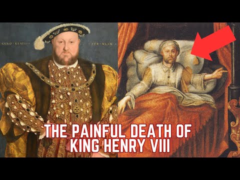 The PAINFUL Death Of King Henry VIII - History's Most BRUTAL King
