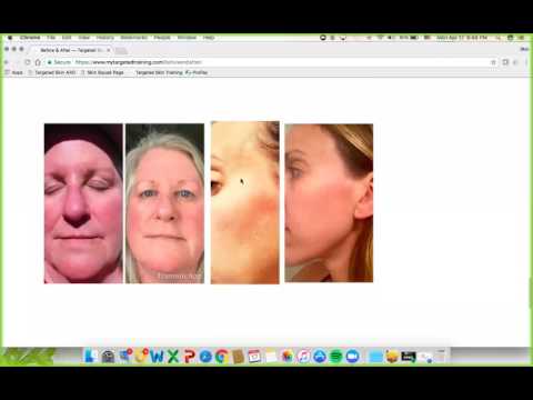 SkinSquad Team Call 4.17.2017