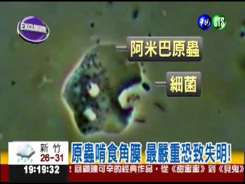 當心阿米巴原蟲! 眼膜恐被吃掉