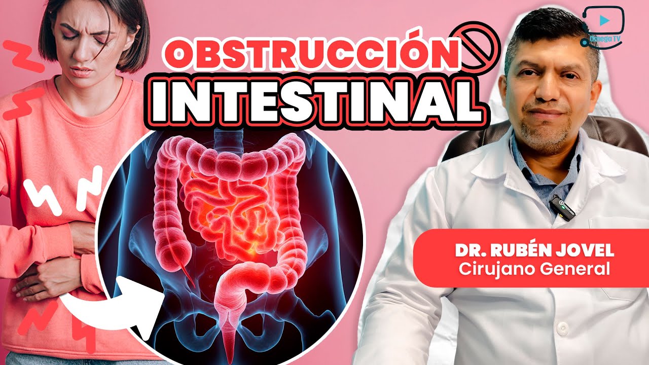 😮¿Qué causa la obstrucción intestinal? Descubre los peligros | Doctor Jovel - Cirujano General