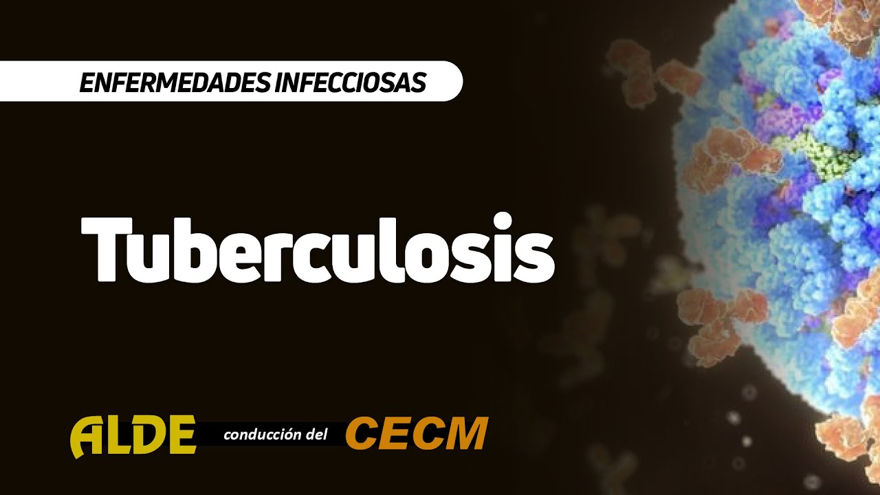 Curso enfermedades infecciosas. Tuberculosis