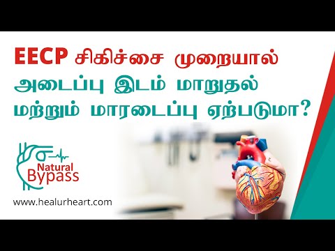 EECP சிகிச்சை முறையால் அடைப்பு இடம் மாறுதல் மற்றும் மாரடைப்பு ஏற்படுமா ?