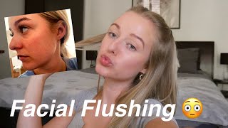 Laser Treatment for Facial Flushing! What to expect, costing, results, aftercare