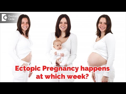 At which week does Ectopic Pregnancy usually happen? - Dr. Archana Kankal of Cloudnine Hospitals