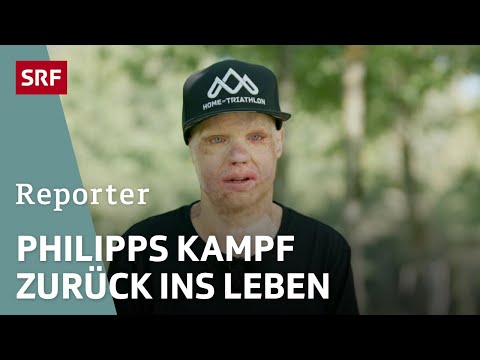 Vom Brandopfer zum Triathlet - Philipp kämpft sich ins Leben zurück | Reportage | SRF