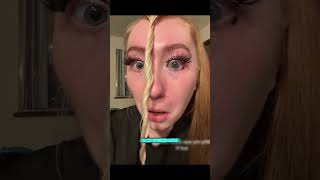 Ela dormiu com as Lentes de Contatos e ISSO ACONTECEU.