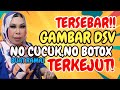 Tersebar Gambar DS Vida 5 Thun Lepas No Cucuk No Botox Buat Ramai Terkejut