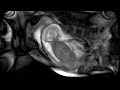 View 9 Mri Scan Pregnancy Baby Face