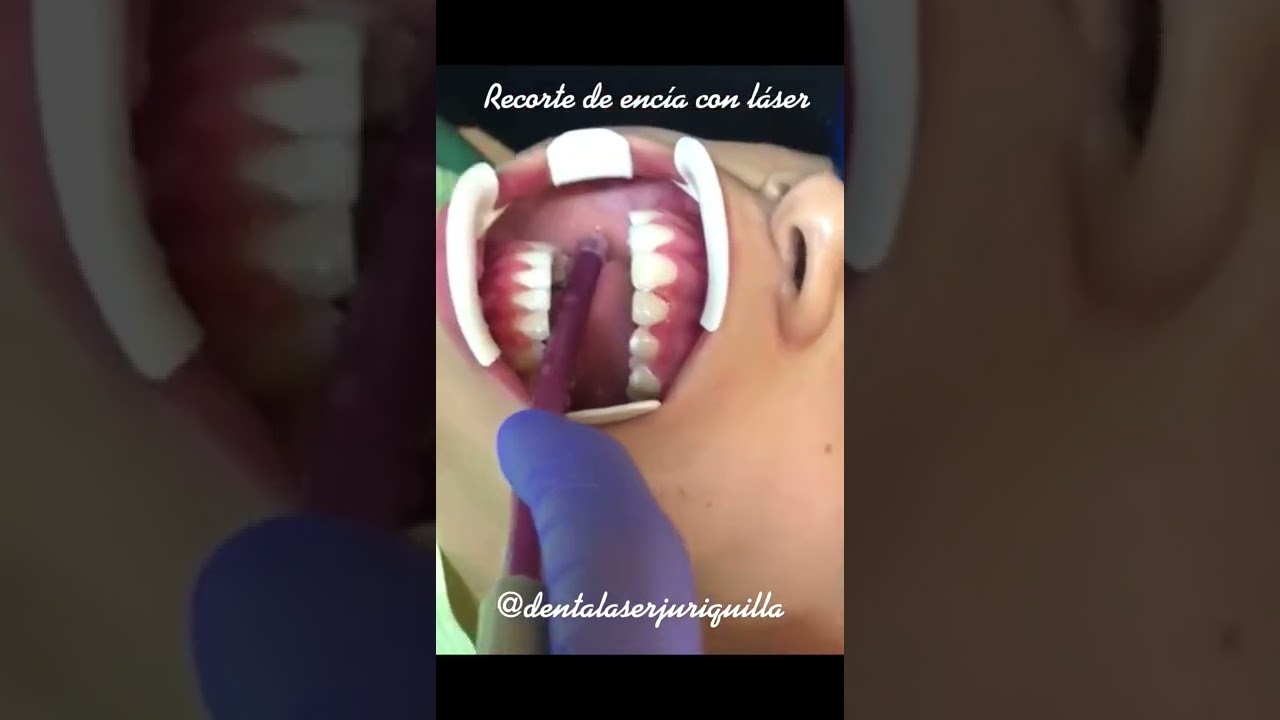 Jonathan Sandoval Robles-16