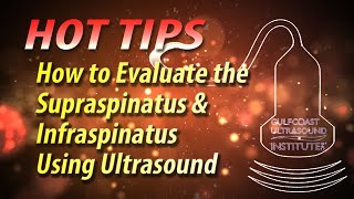 How to Evaluate the Supraspinatus and Infraspinatus Using Ultrasound