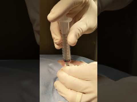 ACVS Connor Treatment Video 2