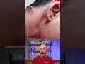 Massive Abscess Pop! #pimplepop #dermreacts #doctorreacts