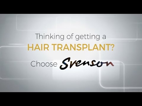 At Svenson, Hair Transplant is Done Properly and Guarantees Lifelong Results