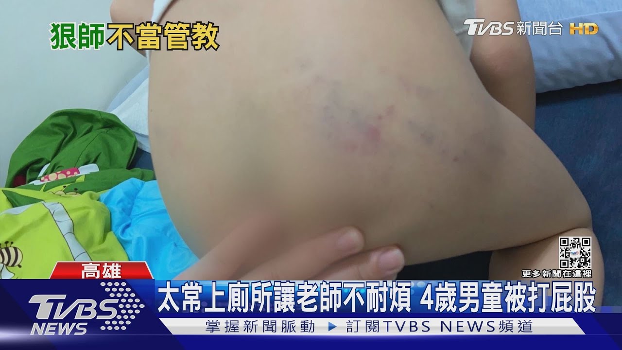 又爆虐童!太活潑、頻尿、逼右手寫字 10多名幼生遭師打