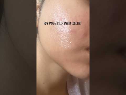 How to tell if your skin barrier is damaged #skincare #shorts