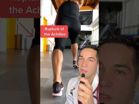 This is what an Achilles tear looks like