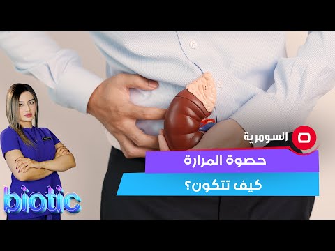 شاهد بالفيديو.. حصوة المرارة كيف تتكون؟