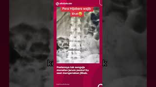 Download lagu Dokter Ingatkan untuk Tidak Simpan Jarum Pentul di Mulut saat Kenakan Jilbab mp3