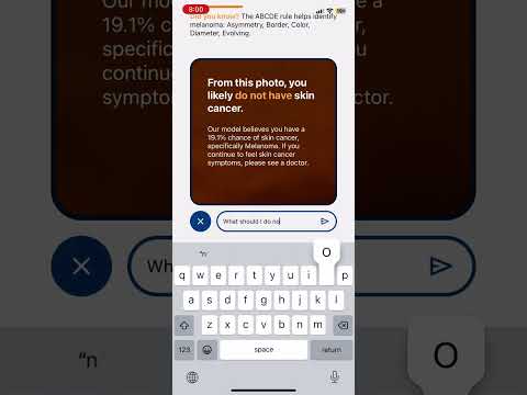 Demo of the skin cancer detection app.