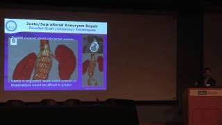 Endovascular Repair of Juxta and Suprarenal Aneurysms