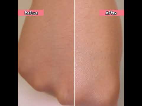 헤이미쉬 아트리스 글로우 베이스